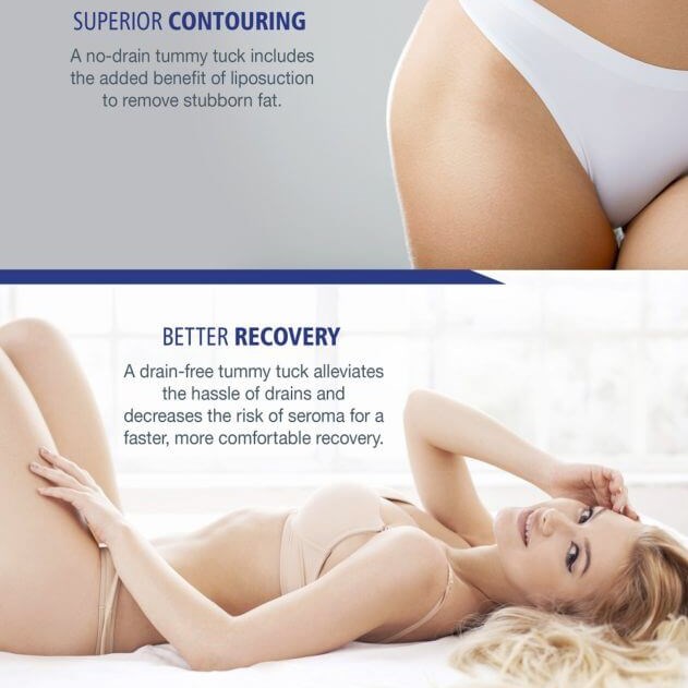 Tummy Tuck