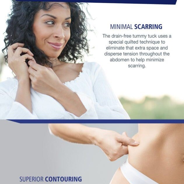 Tummy Tuck