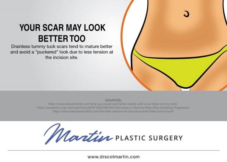 Tummy Tuck