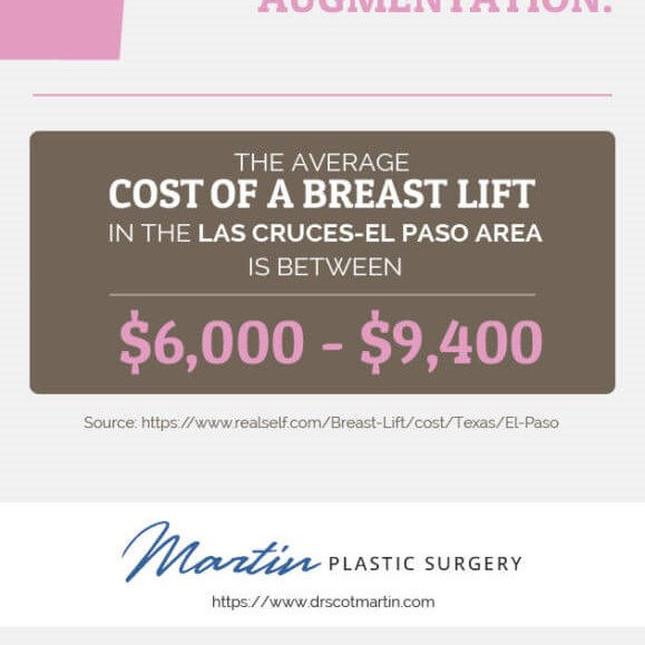 Breast Lift